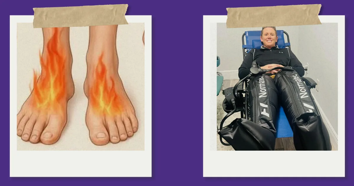 Collage of feet illustrated with burning nerve pain and a patient using compression leg therapy