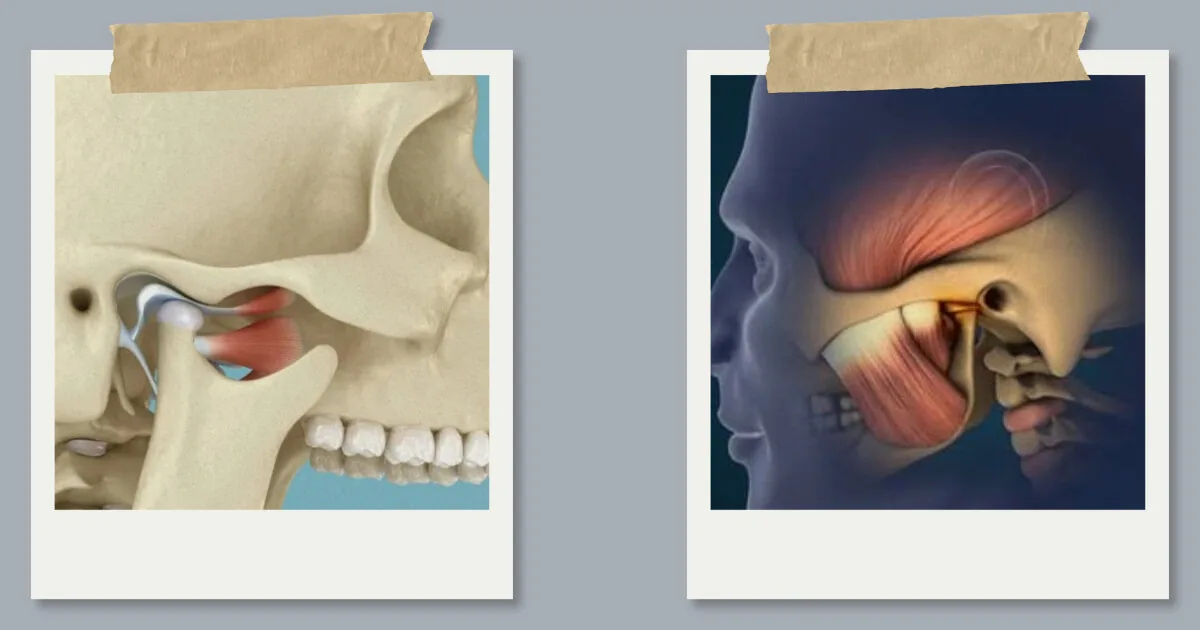 Photo collage of jaw joint anatomy illustrations showing TMJ pain
